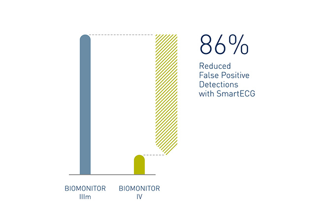 86% reduced false positive detection with smart ECG