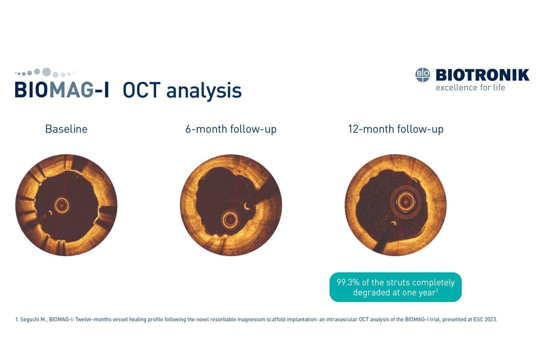 BIOMAG-I OCT Analysis